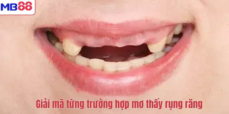 Mơ Thấy Rụng Răng Có Ý Nghĩa Gì? Giải Mã Điềm Báo Cùng MB88 3 Giải mã từng trường hợp mơ thấy rụng răng