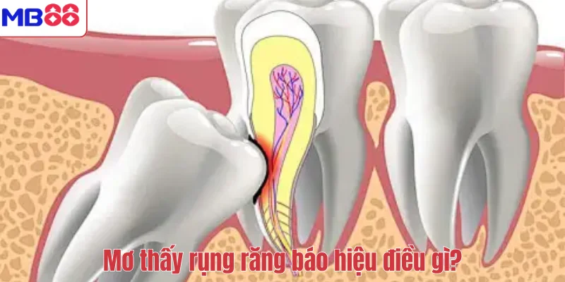 Mơ Thấy Rụng Răng Có Ý Nghĩa Gì? Giải Mã Điềm Báo Cùng MB88 2 Mơ thấy rụng răng báo hiệu điều gì?